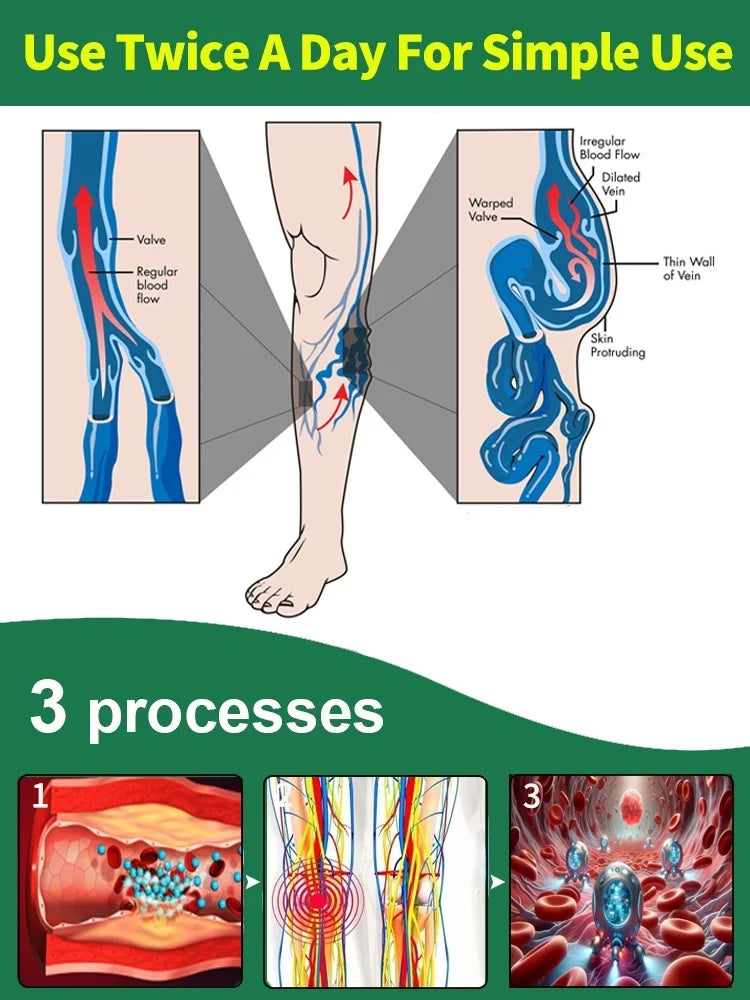 Smooth Legs™ Laser Treatment in 7 Days™