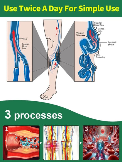 Smooth Legs™ Laser Treatment in 7 Days™